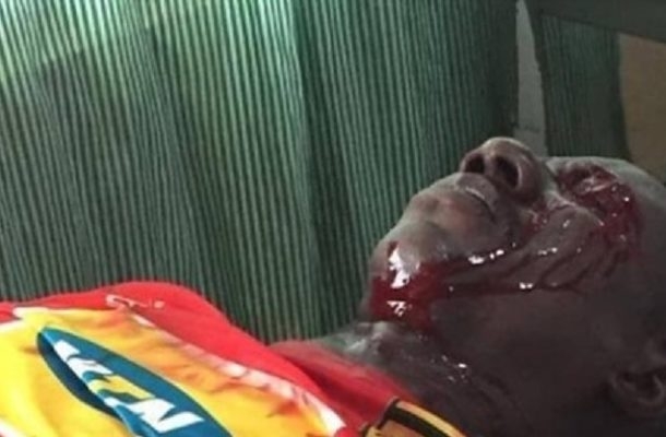 Kotoko fan in critical condition after being shot by police 56