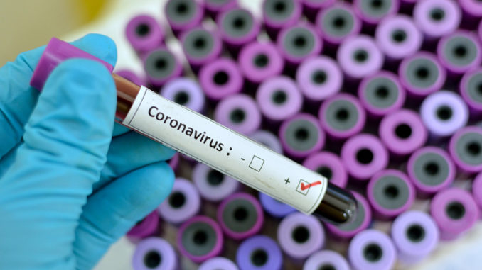 Ghana Records 4 Deaths, 93 Confirmed Coronavirus Cases 59