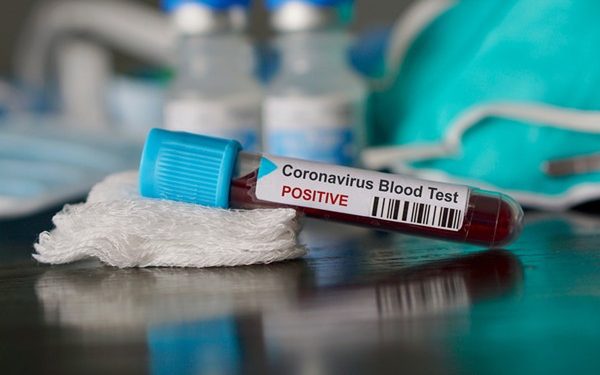 Coronavirus: Young people are not ‘invincible’ - WHO warns 49