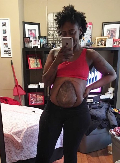 Mum lives with intestines outside her belly after surviving horrific shooting (Photos) 49