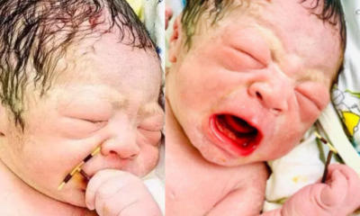 Baby comes out with mother’s contraceptive coil that was to prevent her pregnancy (Photos) 756