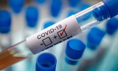 COVID-19: Ghana’s case count hits 30, 366 after 694 new infections 282