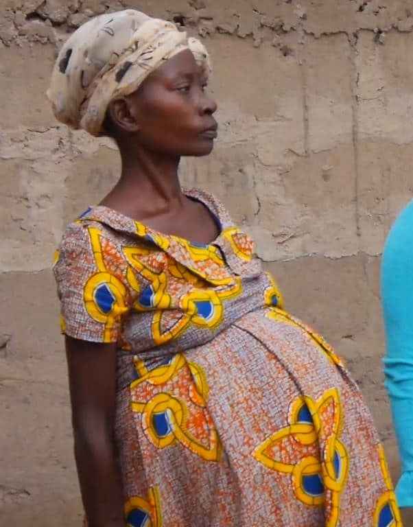 SHOCKER: Woman Pregnant For 13 Years, But What She Got Removed From Her Belly Will Shock You -VIDEO/PHOTOS 48