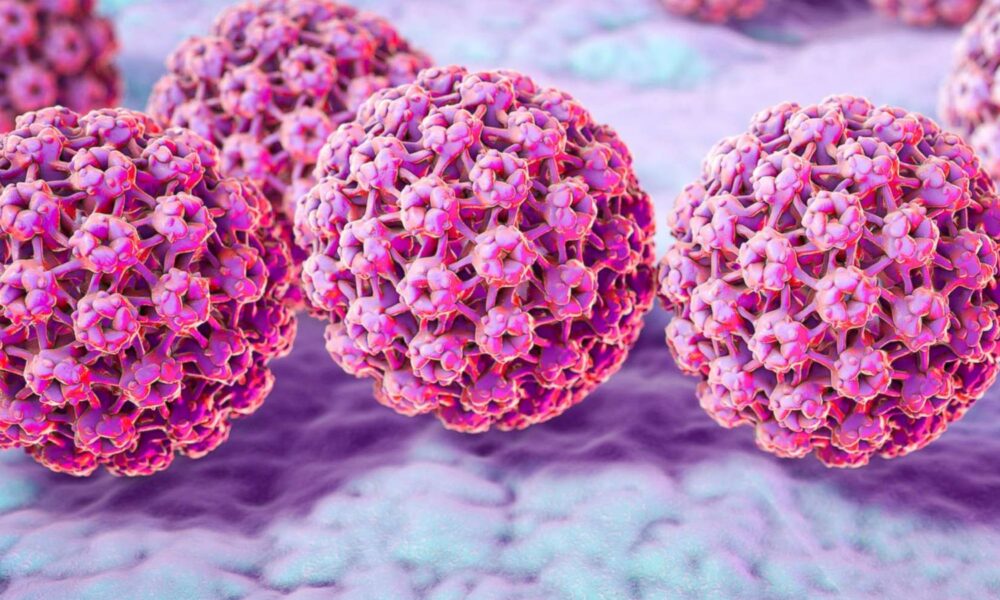 hpv causes prostate cancer papillomatosis and lymphedema