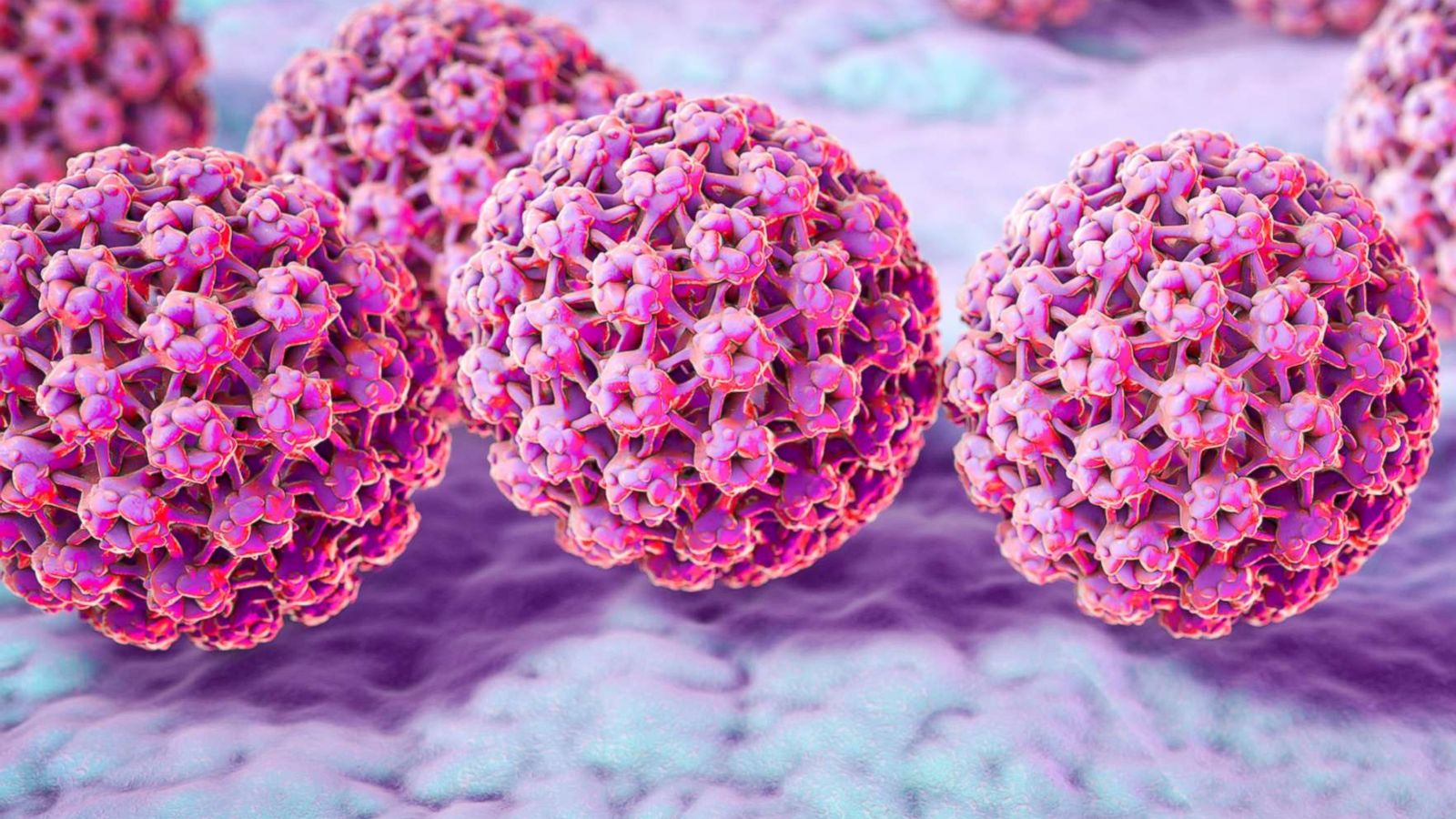 does hpv cause prostate cancer