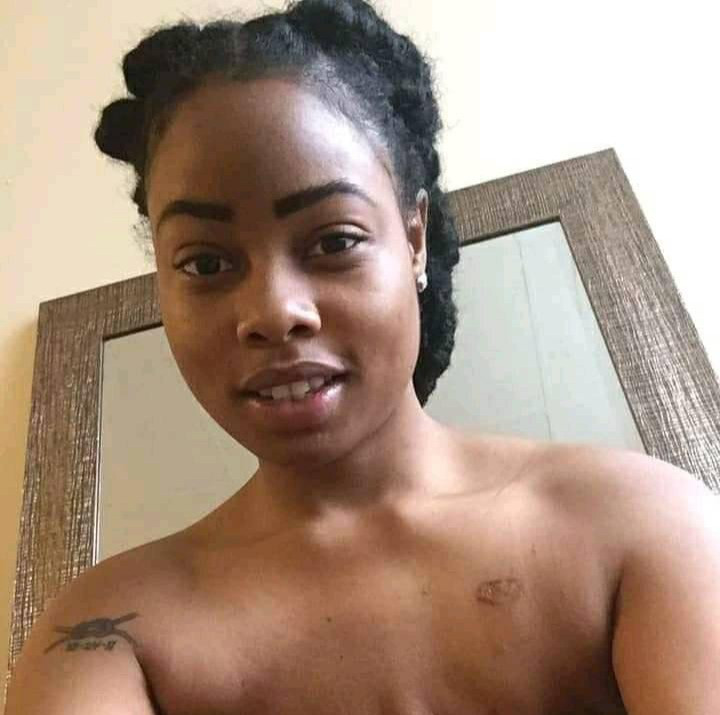 Breast cancer survivor shares topless photo after undergoing double mastectomy as she advices women. 49
