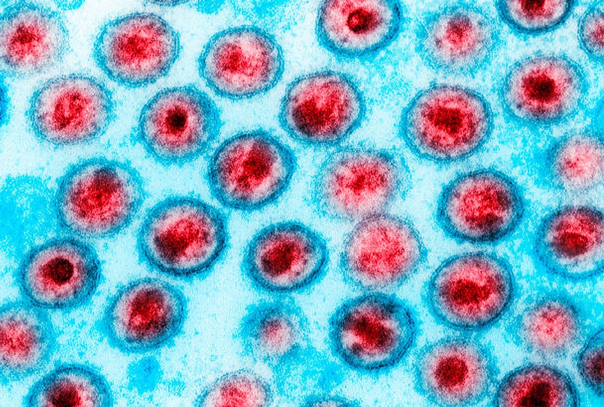 Scientists say the technology behind COVID-19 mRNA vaccines could be adapted to an HIV vaccine. 46