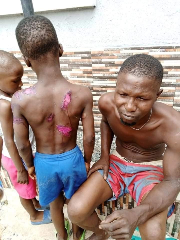 Man arrested for using hot knife to brutalize his son - (Photos). 1