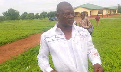 Alan camp disturbed. Condemns beating of agent and electoral malpractices 69